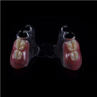 Gigi Tiruan Sebagian Akrilik Lepasan