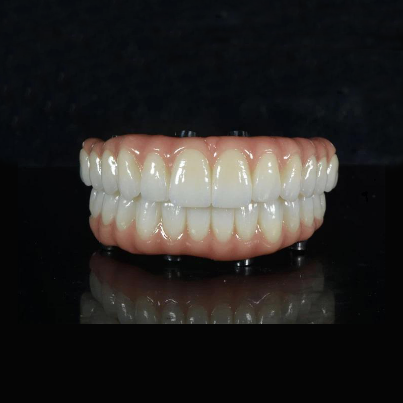 JEMBATAN ZIRCONIA ALL-ON -X
