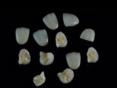 Cara Memilih Lem Gigi Terbaik untuk Mahkota: Panduan Terbaru