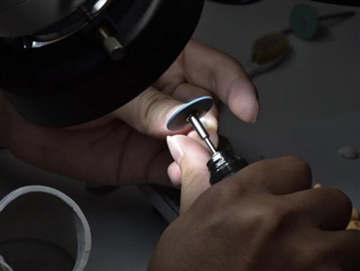 Berapa Lama Mahkota PFM Bertahan? Umur Rata-Rata, Faktor & Tips Perawatan