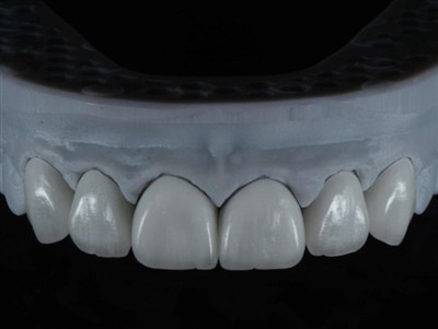 Cara Mengalihdayakan Teknisi Lab Gigi ke Luar Negeri: Panduan Komprehensif